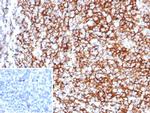 CD35/CR1 (Follicular Dendritic Cell Marker) Antibody in Immunohistochemistry (Paraffin) (IHC (P))