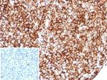 CD35/CR1 (Follicular Dendritic Cell Marker) Antibody in Immunohistochemistry (Paraffin) (IHC (P))