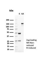 CD35/CR1 (Follicular Dendritic Cell Marker) Antibody in SDS-PAGE (SDS-PAGE)