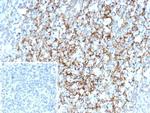 CD35/CR1 (Follicular Dendritic Cell Marker) Antibody in Immunohistochemistry (Paraffin) (IHC (P))