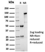 CD35/CR1 (Follicular Dendritic Cell Marker) Antibody in SDS-PAGE (SDS-PAGE)