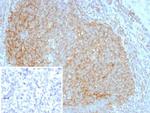 CD35/CR1 (Follicular Dendritic Cell Marker) Antibody in Immunohistochemistry (Paraffin) (IHC (P))