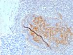 CD35/CR1 (Follicular Dendritic Cell Marker) Antibody in Immunohistochemistry (Paraffin) (IHC (P))