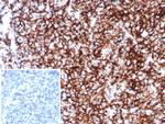 CD35/CR1 (Follicular Dendritic Cell Marker) Antibody in Immunohistochemistry (Paraffin) (IHC (P))