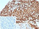 CD35/CR1 (Follicular Dendritic Cell Marker) Antibody in Immunohistochemistry (Paraffin) (IHC (P))