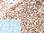 CD35/CR1 (Follicular Dendritic Cell Marker) Antibody in Immunohistochemistry (Paraffin) (IHC (P))