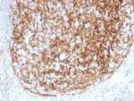 CD35/CR1 (Follicular Dendritic Cell Marker) Antibody in Immunohistochemistry (Paraffin) (IHC (P))