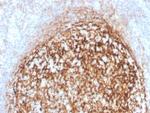 CD35/CR1 (Follicular Dendritic Cell Marker) Antibody in Immunohistochemistry (Paraffin) (IHC (P))