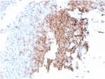 CD21 (Mature B-Cell and Follicular Dendritic Cell Marker) Antibody in Immunohistochemistry (Paraffin) (IHC (P))