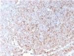 CD21 (Mature B-Cell and Follicular Dendritic Cell Marker) Antibody in Immunohistochemistry (Paraffin) (IHC (P))