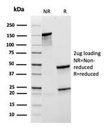 CD21 (Mature B-Cell and Follicular Dendritic Cell Marker) Antibody in SDS-PAGE (SDS-PAGE)