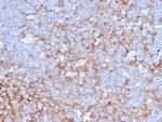 CD21 (Mature B-Cell and Follicular Dendritic Cell Marker) Antibody in Immunohistochemistry (Paraffin) (IHC (P))