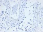 CD21 (Mature B-Cell and Follicular Dendritic Cell Marker) Antibody in Immunohistochemistry (Paraffin) (IHC (P))