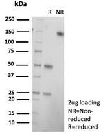 CD21 (Mature B-Cell and Follicular Dendritic Cell Marker) Antibody in Immunohistochemistry (Paraffin) (IHC (P))