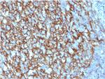 CD21 (Mature B-Cell and Follicular Dendritic Cell Marker) Antibody in Immunohistochemistry (Paraffin) (IHC (P))