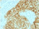 CD21 (Mature B-Cell and Follicular Dendritic Cell Marker) Antibody in Immunohistochemistry (Paraffin) (IHC (P))