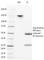 CD21 (Mature B-Cell and Follicular Dendritic Cell Marker) Antibody in SDS-PAGE (SDS-PAGE)