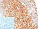 CD21 (Mature B-Cell and Follicular Dendritic Cell Marker) Antibody in Immunohistochemistry (Paraffin) (IHC (P))