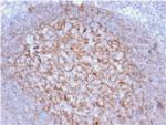 CD21 (Mature B-Cell and Follicular Dendritic Cell Marker) Antibody in Immunohistochemistry (Paraffin) (IHC (P))