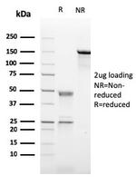 CD21 Antibody in SDS-PAGE (SDS-PAGE)