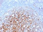 CD21 (Mature B-Cell and Follicular Dendritic Cell Marker) Antibody in Immunohistochemistry (Paraffin) (IHC (P))