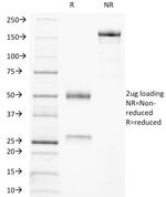 CD21 (Mature B-Cell and Follicular Dendritic Cell Marker) Antibody in SDS-PAGE (SDS-PAGE)