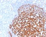 CD21 (Mature B-Cell and Follicular Dendritic Cell Marker) Antibody in Immunohistochemistry (Paraffin) (IHC (P))