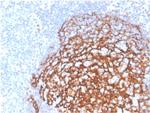 CD21 (Mature B-Cell and Follicular Dendritic Cell Marker) Antibody in Immunohistochemistry (Paraffin) (IHC (P))