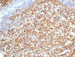 CD21 (Mature B-Cell and Follicular Dendritic Cell Marker) Antibody in Immunohistochemistry (Paraffin) (IHC (P))