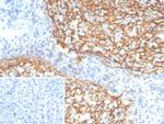 CD21 (Mature B-Cell and Follicular Dendritic Cell Marker) Antibody in Immunohistochemistry (Paraffin) (IHC (P))