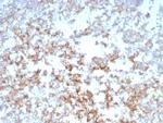 CD21 (Mature B-Cell and Follicular Dendritic Cell Marker) Antibody in Immunohistochemistry (Paraffin) (IHC (P))