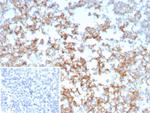 CD21 (Mature B-Cell and Follicular Dendritic Cell Marker) Antibody in Immunohistochemistry (Paraffin) (IHC (P))