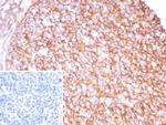 CD21 (Mature B-Cell and Follicular Dendritic Cell Marker) Antibody in Immunohistochemistry (Paraffin) (IHC (P))