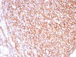 CD21 (Mature B-Cell and Follicular Dendritic Cell Marker) Antibody in Immunohistochemistry (Paraffin) (IHC (P))