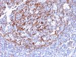 CD21 (Mature B-Cell and Follicular Dendritic Cell Marker) Antibody in Immunohistochemistry (Paraffin) (IHC (P))