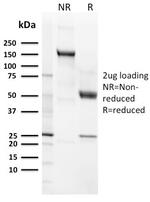 CD21 (Mature B-Cell and Follicular Dendritic Cell Marker) Antibody in SDS-PAGE (SDS-PAGE)