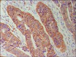 Connexin 26 Antibody in Immunohistochemistry (IHC)