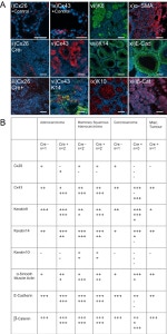 Connexin 26 Antibody in Immunohistochemistry (IHC)