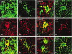 Connexin 32 Antibody in Immunohistochemistry (IHC)