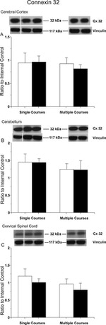 Connexin 32 Antibody in Western Blot (WB)