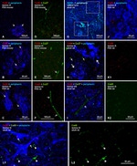 Connexin 43 Antibody in Immunohistochemistry (IHC)