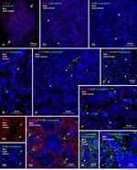 Connexin 43 Antibody in Immunohistochemistry (IHC)