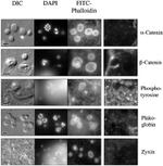 Phosphotyrosine Antibody in Immunocytochemistry (ICC/IF)