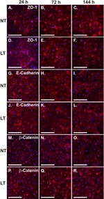 beta Catenin Antibody in Immunocytochemistry (ICC/IF)