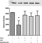 beta Catenin Antibody in Western Blot (WB)