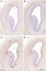 beta Catenin Antibody in Immunohistochemistry (IHC)