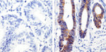 beta Catenin Antibody in Immunohistochemistry (Paraffin) (IHC (P))