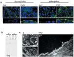 gamma Catenin Antibody in Immunocytochemistry (ICC/IF)