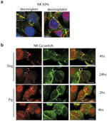 gamma Catenin Antibody in Immunocytochemistry (ICC/IF)