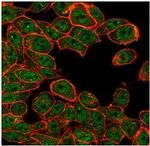 ATF2 Antibody in Immunocytochemistry (ICC/IF)